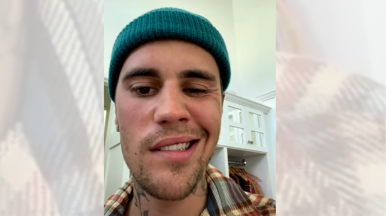 Justin Bieber showing his face paralysis caused by a rare syndrome. 