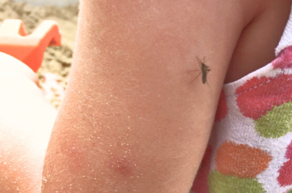 WEST NILE - -MOSQUITO ON GIRL'S ARM